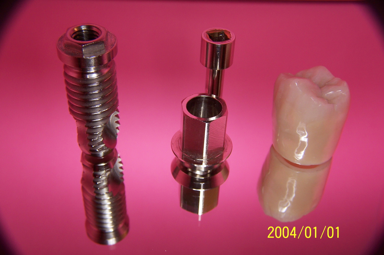 Implant dentaire : Une dent artificielle très solide ?